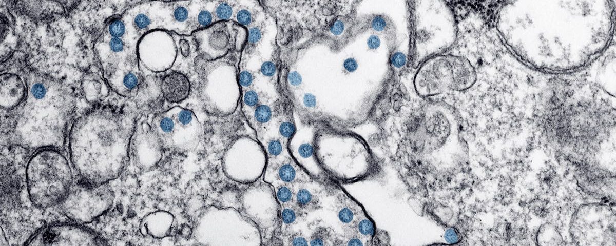 découvrez l'univers fascinant du microbiome, ces milliards de micro-organismes qui habitent notre corps et influencent notre santé, notre humeur et notre bien-être. apprenez comment le microbiome joue un rôle crucial dans la digestion, le système immunitaire et bien plus encore.