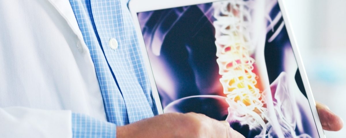 doctor showing xray 1 - Dr Sylvain Desforges