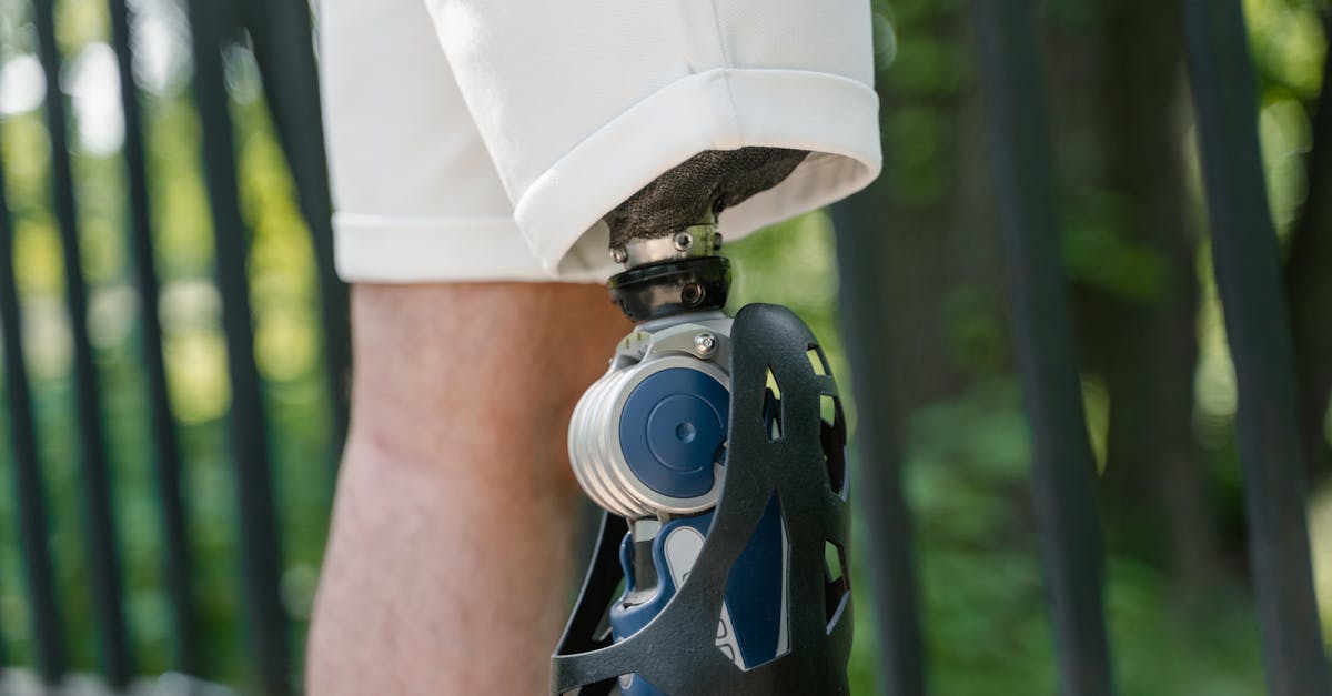 découvrez les dernières innovations en médecine du sport, allant des traitements avancés aux technologies révolutionnaires qui améliorent la performance des athlètes et favorisent une récupération optimale.