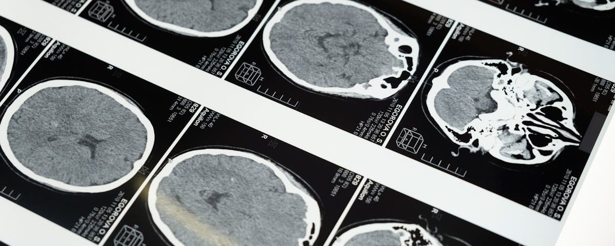 découvrez les dernières innovations et avancées en médecine du sport grâce à la technologie. explorez comment les outils et techniques modernes améliorent la performance, la récupération et la santé des athlètes.