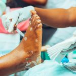 découvrez les bienfaits de la thérapie par ondes de choc, une technique innovante utilisée pour traiter les douleurs chroniques, les blessures sportives et améliorer la guérison. transformez votre vie avec des séances personnalisées, efficaces et non invasives.