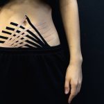 découvrez comment la médecine du sport optimise la performance athlétique, traite les blessures et promeut une récupération rapide pour les sportifs de tous niveaux.