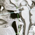 découvrez la médecine fonctionnelle, une approche holistique et personnalisée de la santé qui vise à traiter les causes profondes des maladies plutôt que de simplement atténuer les symptômes. apprenez comment cette discipline intégrative peut vous aider à optimiser votre bien-être et à atteindre un équilibre durable.