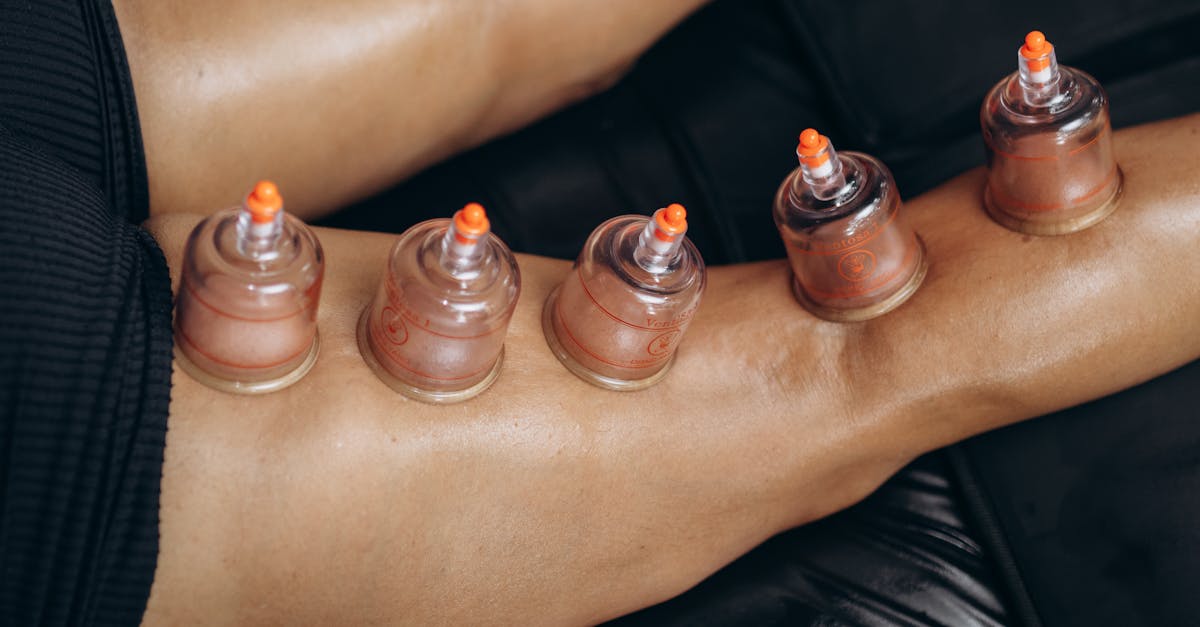 découvrez la médecine fonctionnelle, une approche holistique qui vise à identifier et traiter les causes profondes des maladies. apprenez comment cette discipline intégrative combine nutrition, mode de vie et médecine traditionnelle pour améliorer votre santé globale.