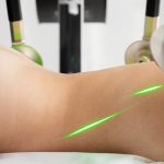 découvrez les bienfaits de la thérapie au laser, une méthode innovante et non invasive pour soulager la douleur, accélérer la guérison et améliorer votre bien-être. explorez cette technologie avancée qui transforme le traitement médical.